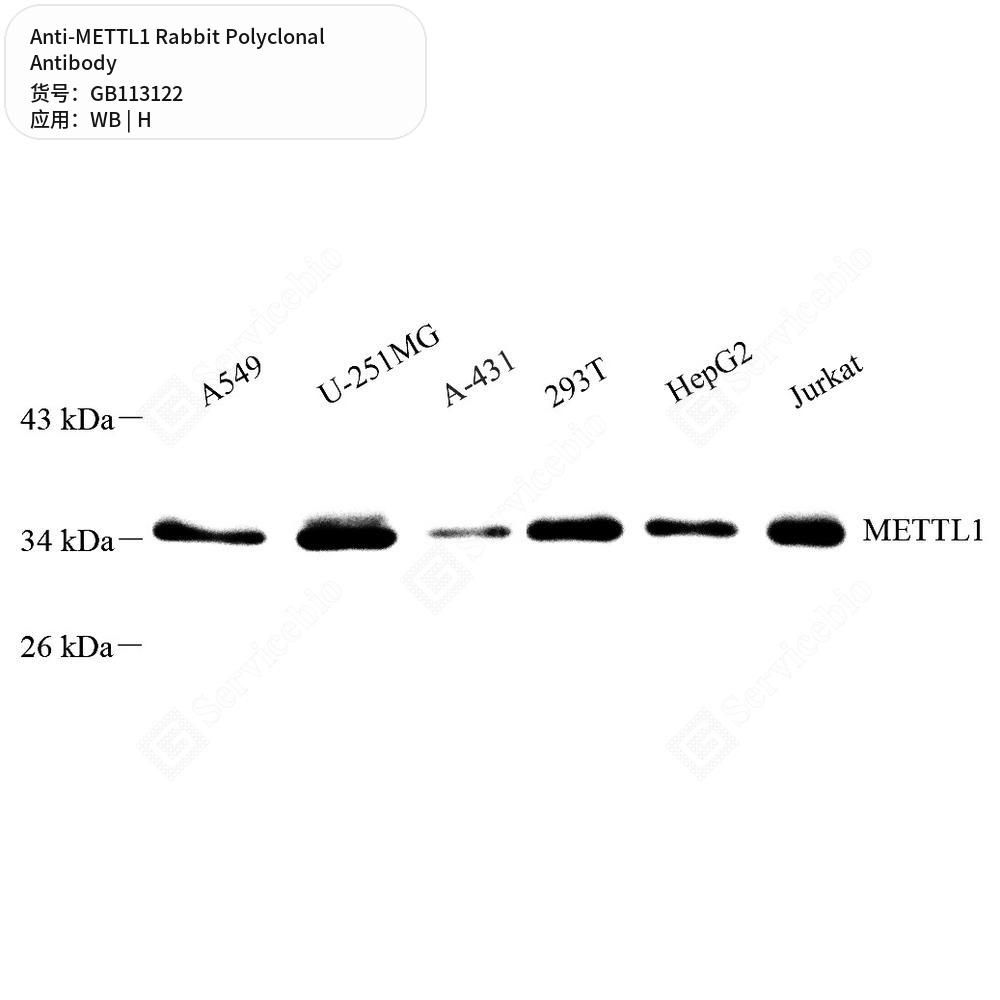 Антитела первичные, поликлональные кролика к METTL1 человека, 50 мкл