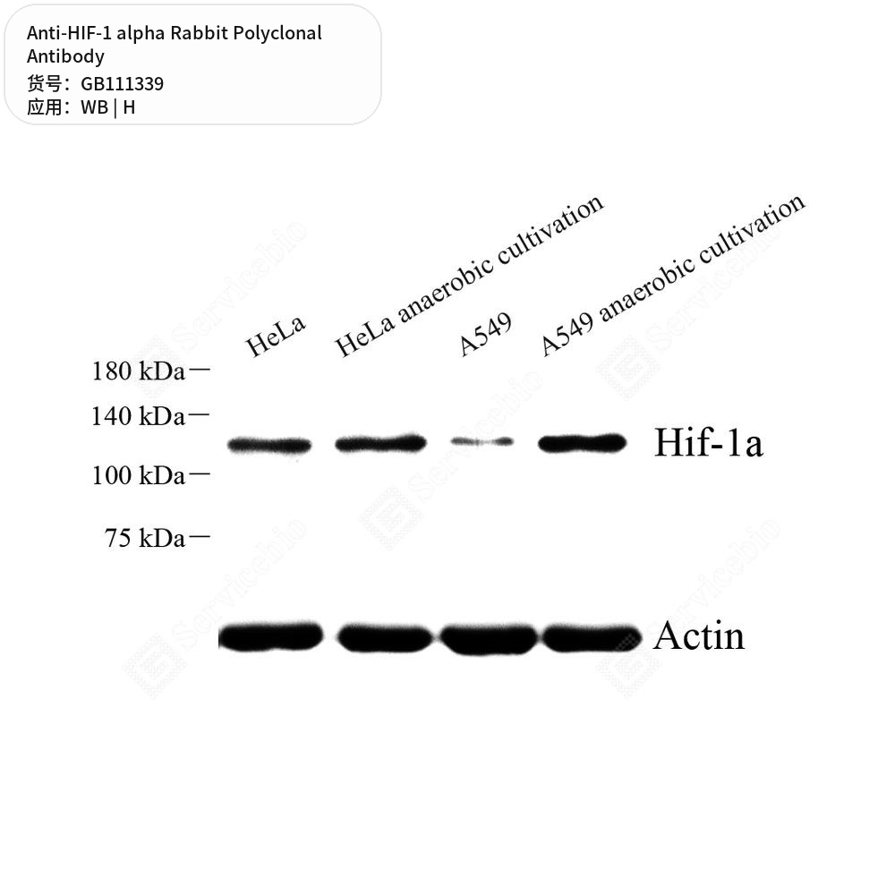 Антитела первичные, поликлональные кролика к HIF-1 alpha человека, 100 мкл