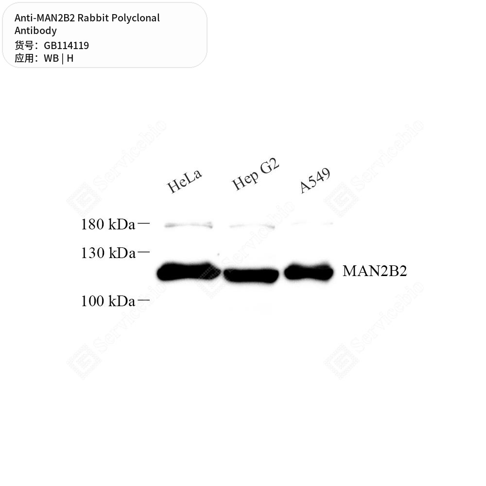 Антитела первичные, поликлональные кролика к MAN2B2 человека, 50 мкл