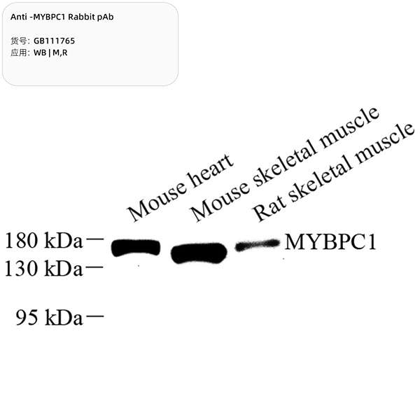 Антитела первичные, поликлональные, MYBPC1, 100 мкл