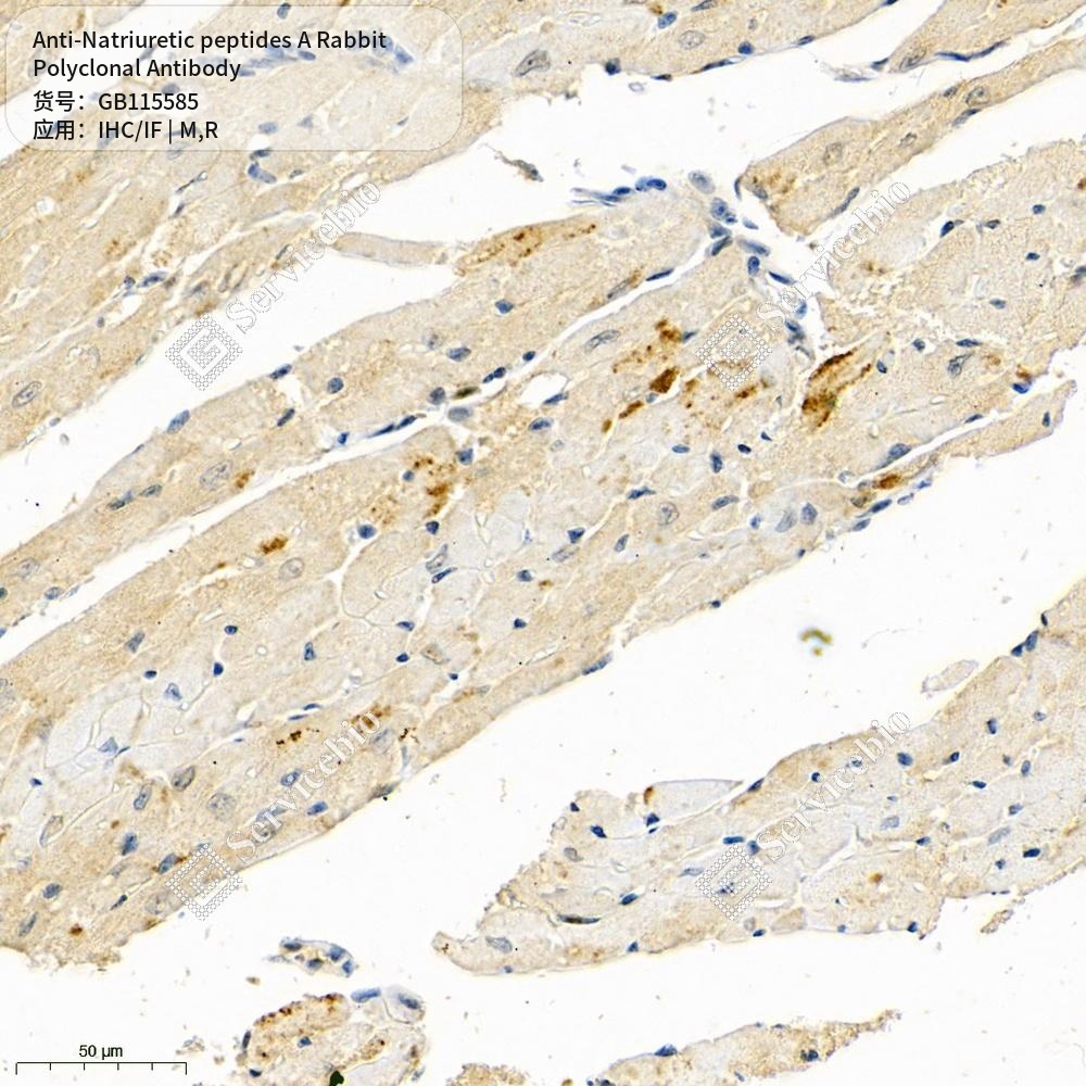 Антитела первичные, поликлональные кролика к Natriuretic peptides A крысы, мыши, 50 мкл