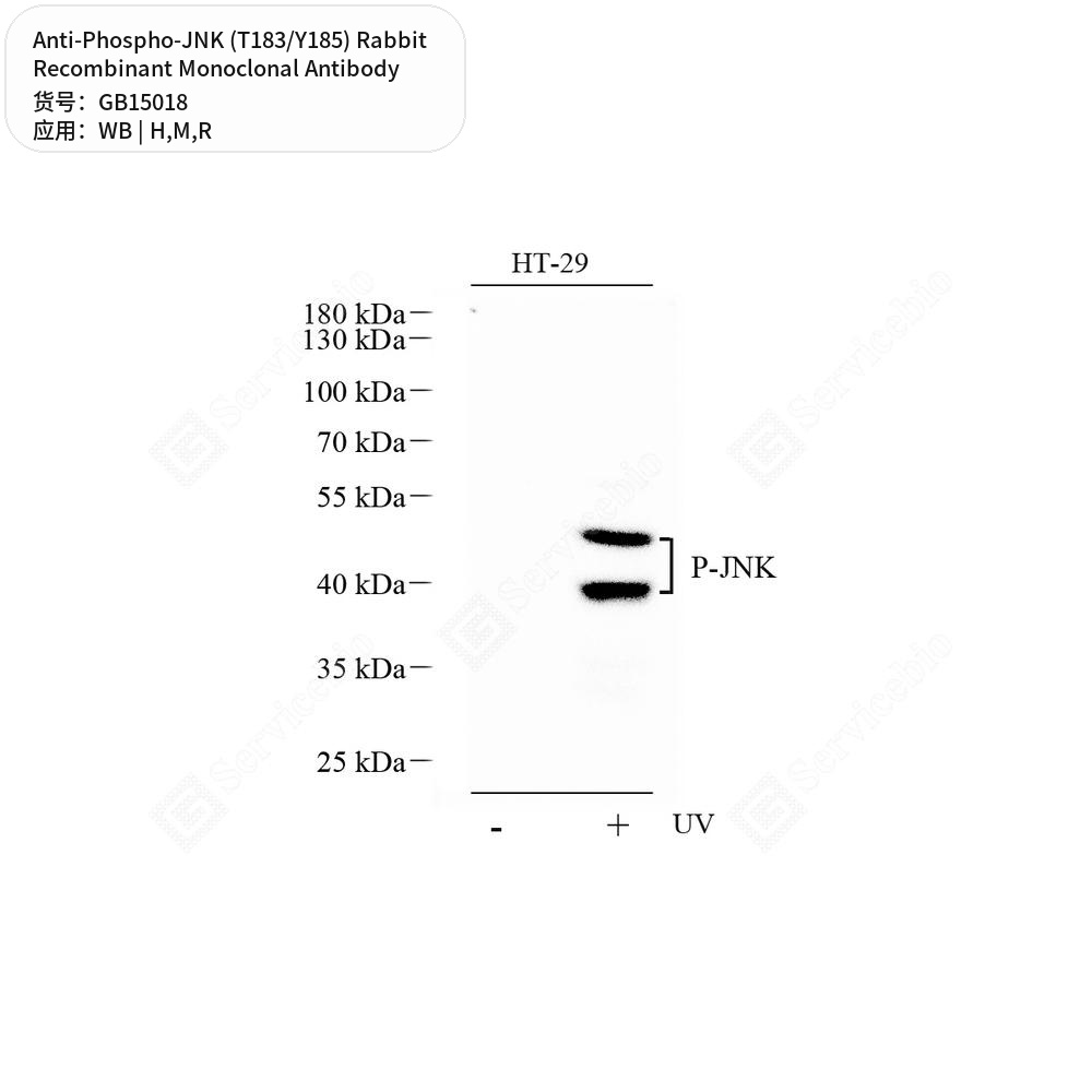 Антитела первичные, моноклональные кролика к Phospho-JNK (T183/Y185) крысы, мыши, человека, 100 мкл