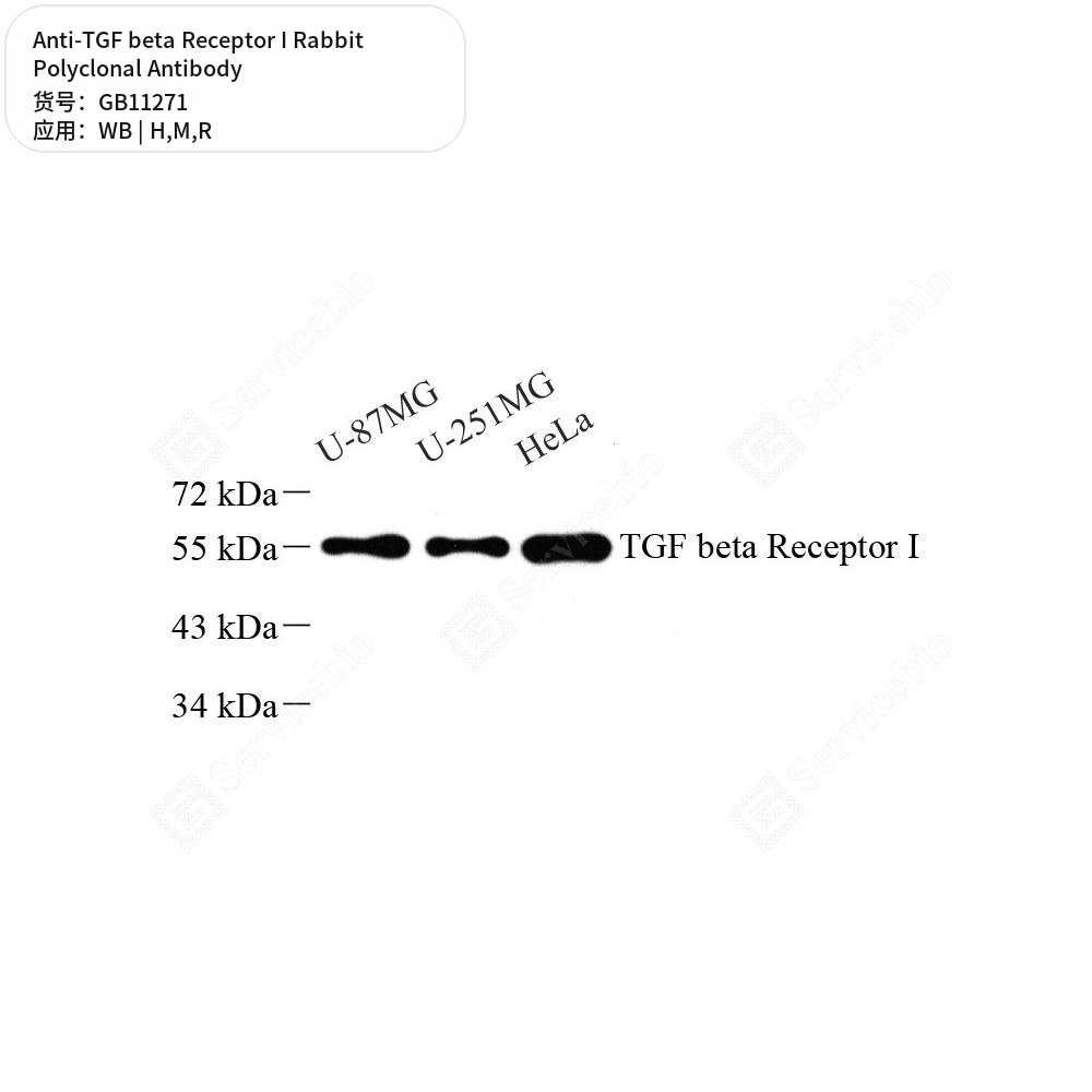 Антитела первичные, поликлональные кролика к TGF beta Receptor I крысы, мыши, человека, 100 мкл