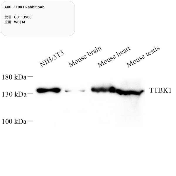 Антитела первичные, поликлональные, TTBK1, 100 мкл