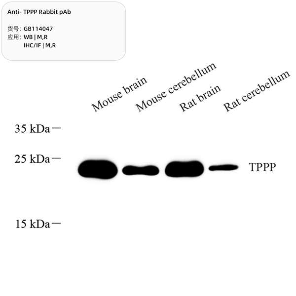 Антитела первичные, поликлональные, TPPP, 100 мкл