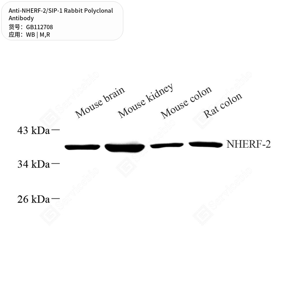 Антитела первичные, поликлональные кролика к NHERF-2/SIP-1 крысы, мыши, 100 мкл