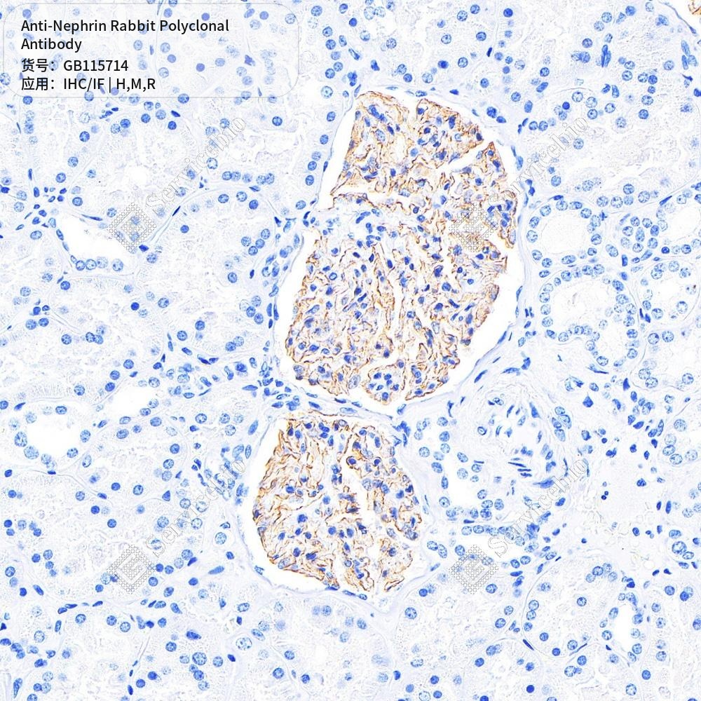 Антитела первичные, поликлональные кролика к Nephrin крысы, мыши, человека, 50 мкл
