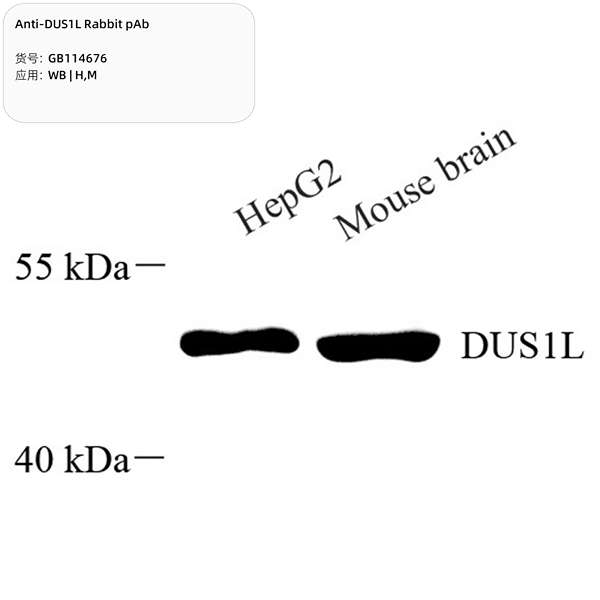 Антитела первичные, поликлональные, DUS1L, 100 мкл