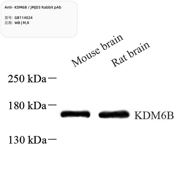 Антитела первичные, поликлональные, KDM6B/JMJD3, 100 мкл