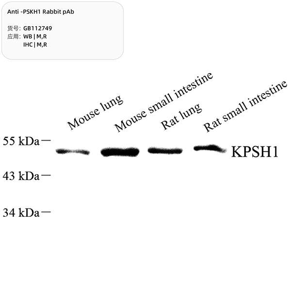 Антитела первичные, поликлональные, PSKH1, 100 мкл