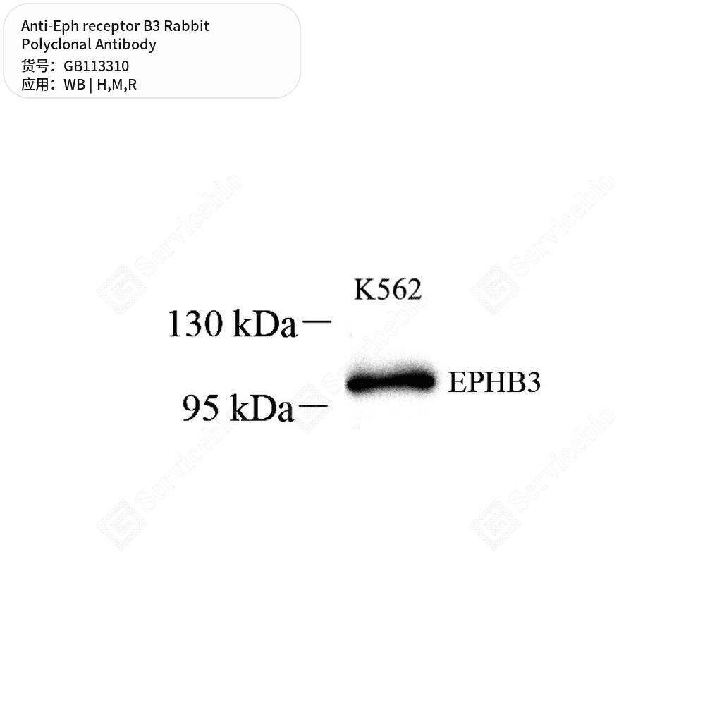 Антитела первичные, поликлональные кролика к Eph receptor B3 крысы, мыши, человека, 50 мкл