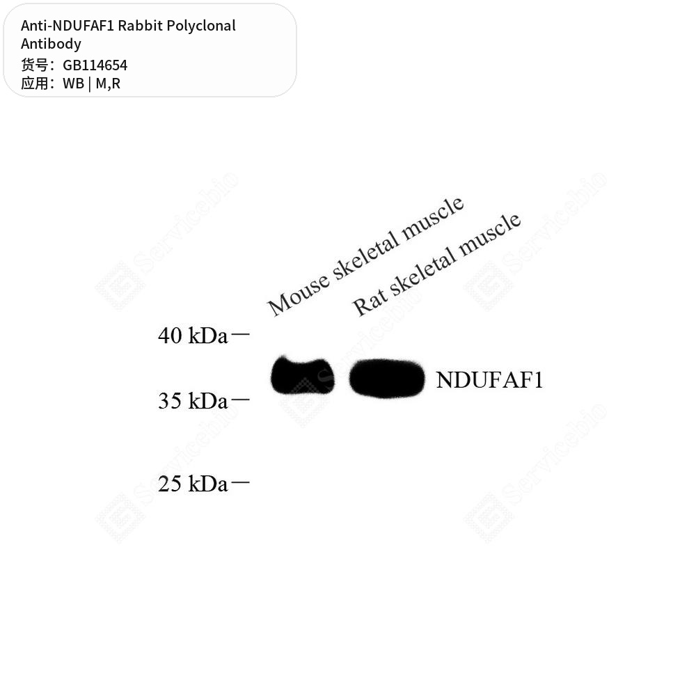 Антитела первичные, поликлональные кролика к NDUFAF1 крысы, мыши, 100 мкл