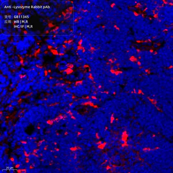 Антитела первичные, поликлональные, Lysozyme, 100 мкл