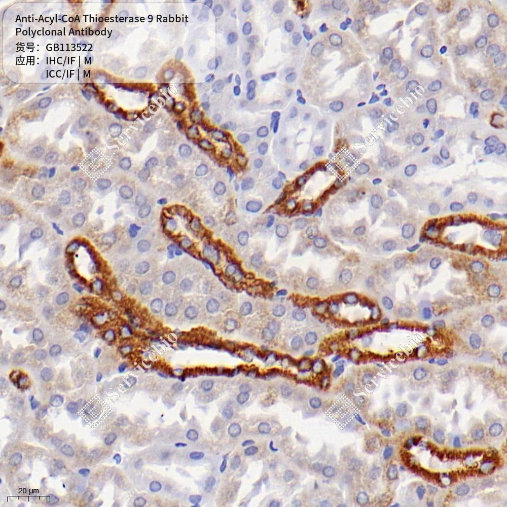Антитела первичные, поликлональные кролика к Acyl-CoA Thioesterase 9 мыши, 50 мкл