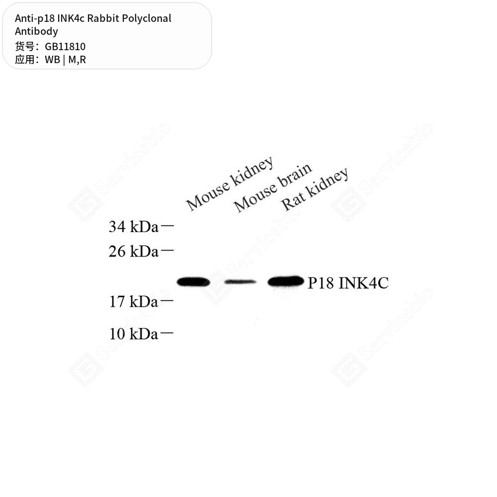 Антитела первичные, поликлональные кролика к p18 INK4c крысы, мыши, 50 мкл