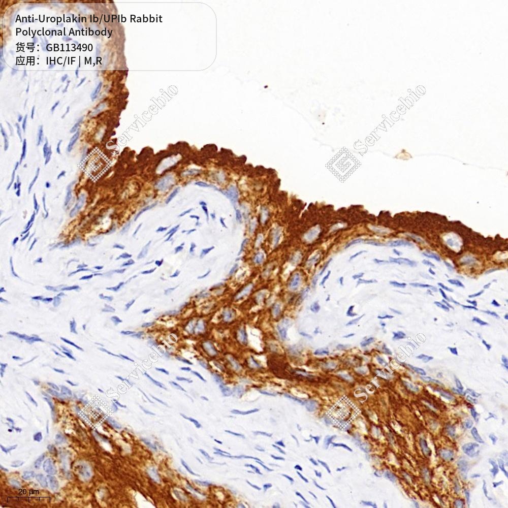 Антитела первичные, поликлональные кролика к Uroplakin Ib/UPIb крысы, мыши, 50 мкл