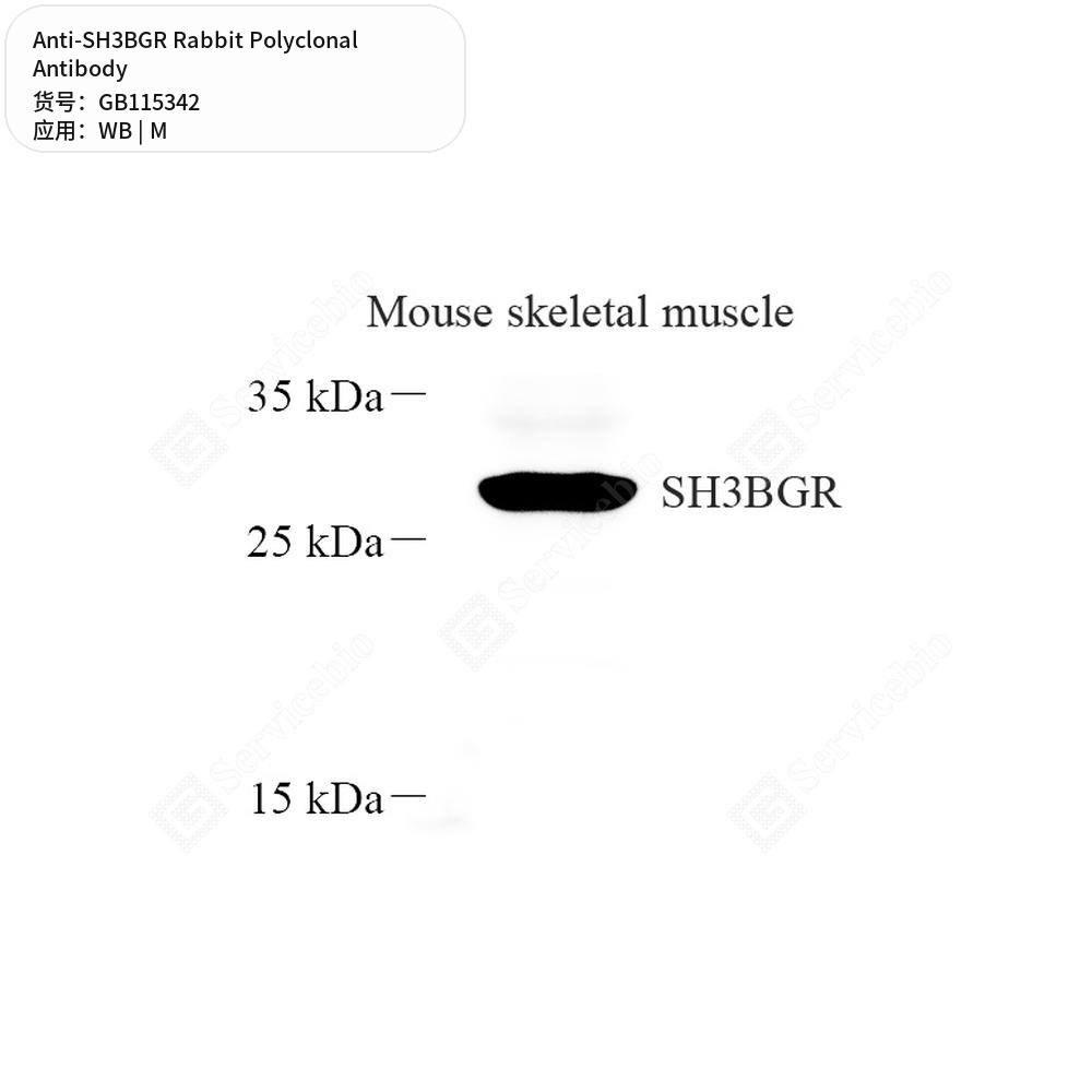 Антитела первичные, поликлональные кролика к SH3BGR мыши, 100 мкл