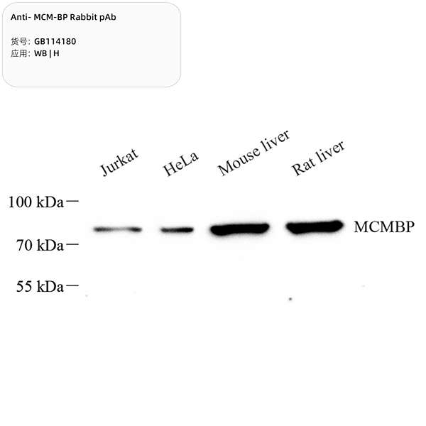 Антитела первичные, поликлональные, MCM-BP, 100 мкл