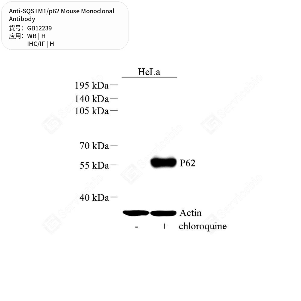 Антитела первичные, моноклональные мыши к SQSTM1/p62 человека, 50 мкл