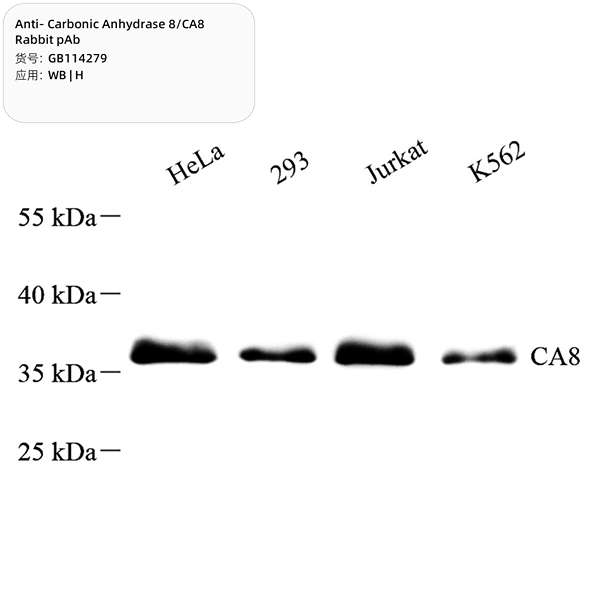 Антитела первичные, поликлональные, Carbonic Anhydrase 8/CA8, 100 мкл