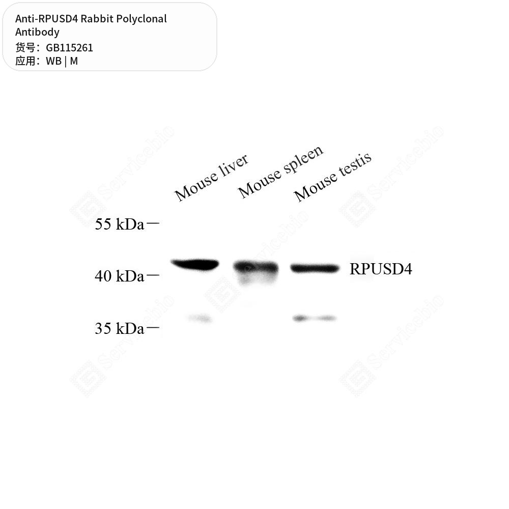 Антитела первичные, поликлональные кролика к RPUSD4 мыши, 50 мкл