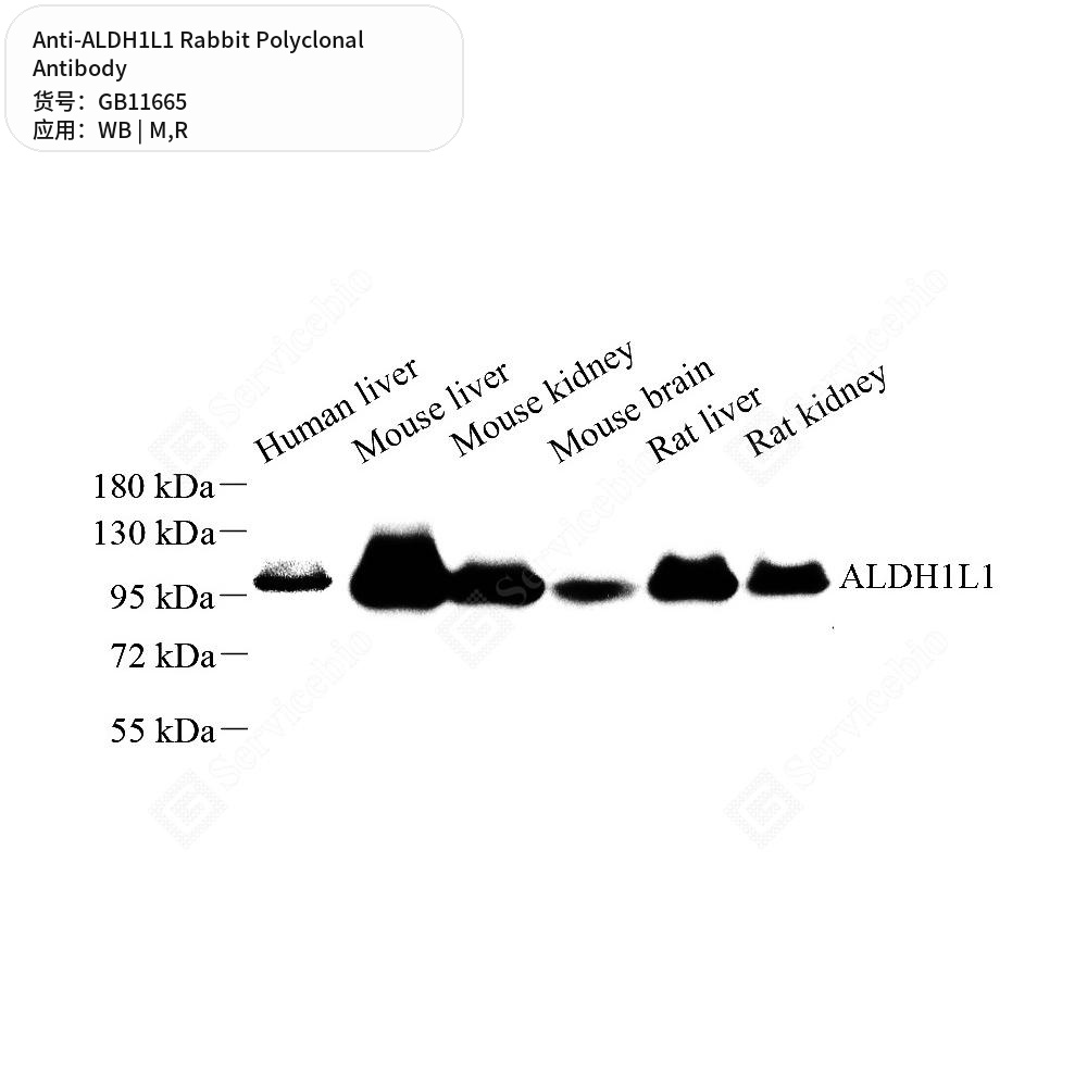 Антитела первичные, поликлональные кролика к ALDH1L1 крысы, мыши, 50 мкл