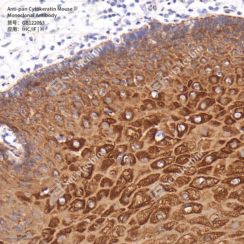Антитела первичные, моноклональные мыши к pan Cytokeratin человека, 50 мкл