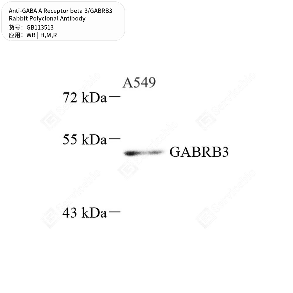 Антитела первичные, поликл. кролика к GABA A Receptor beta 3/GABRB3 крысы, мыши, человека, 50 мкл