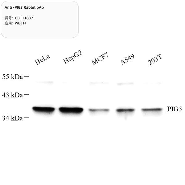 Антитела первичные, поликлональные, PIG3, 100 мкл