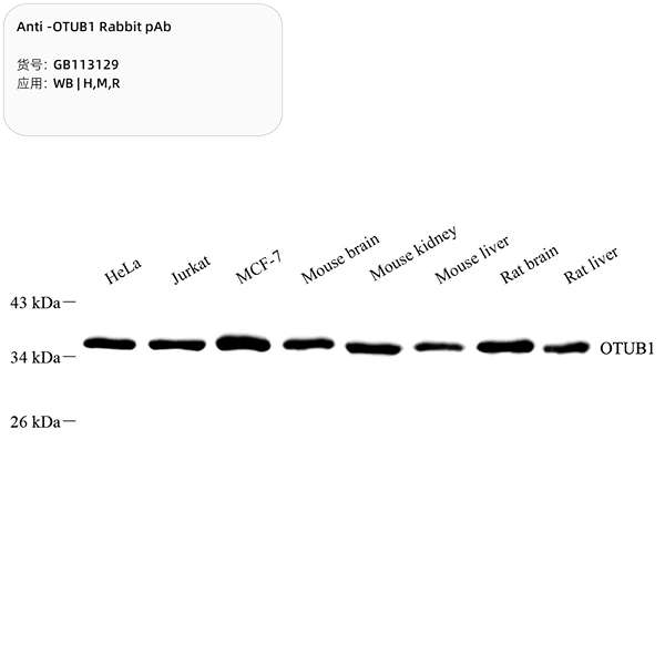 Антитела первичные, поликлональные, OTUB1, 100 мкл