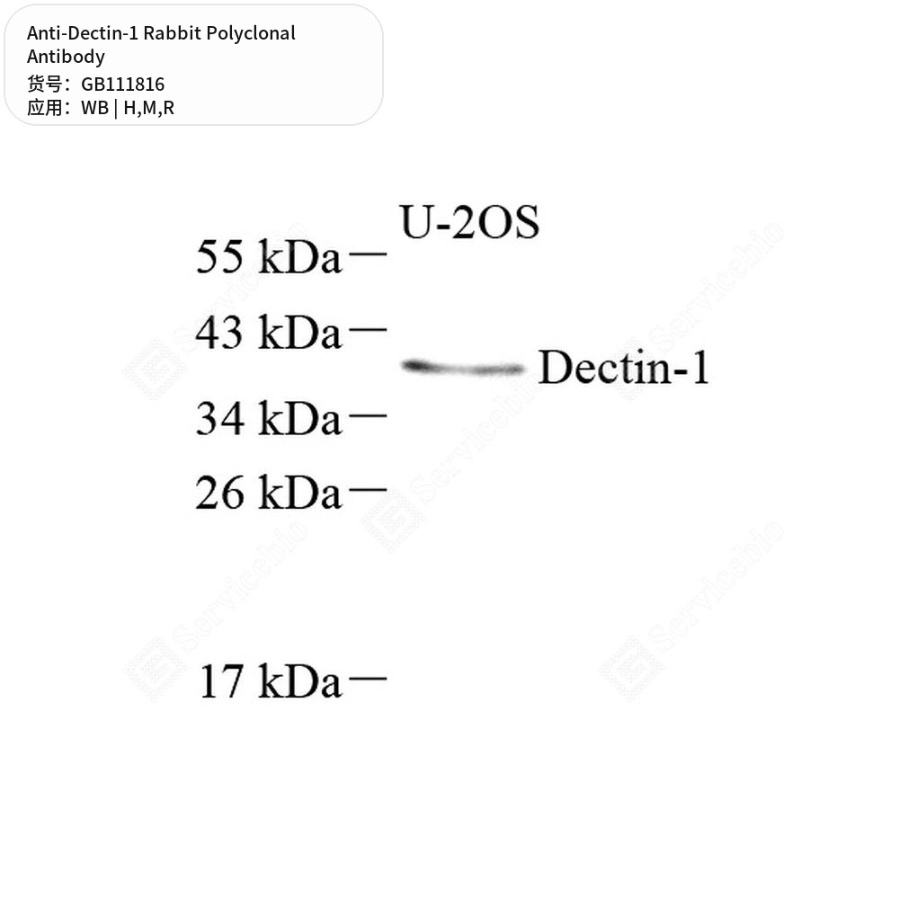Антитела первичные, поликлональные кролика к Dectin-1 крысы, мыши, человека, 100 мкл