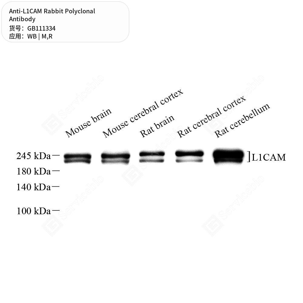 Антитела первичные, поликлональные кролика к L1CAM крысы, мыши, 100 мкл