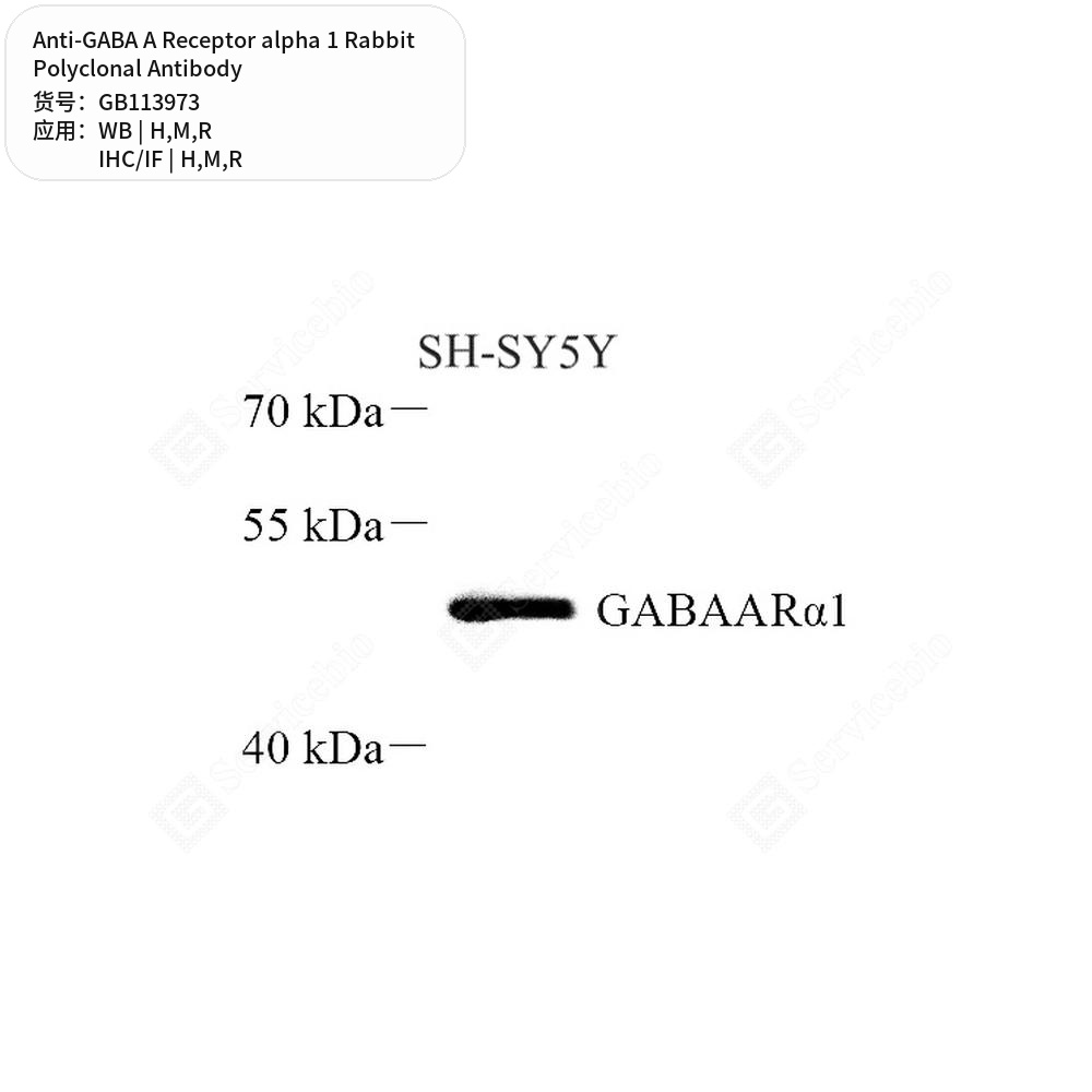 Антитела первичные, поликлональные кролика к GABA A Receptor alpha 1 крысы, мыши, человека, 50 мкл