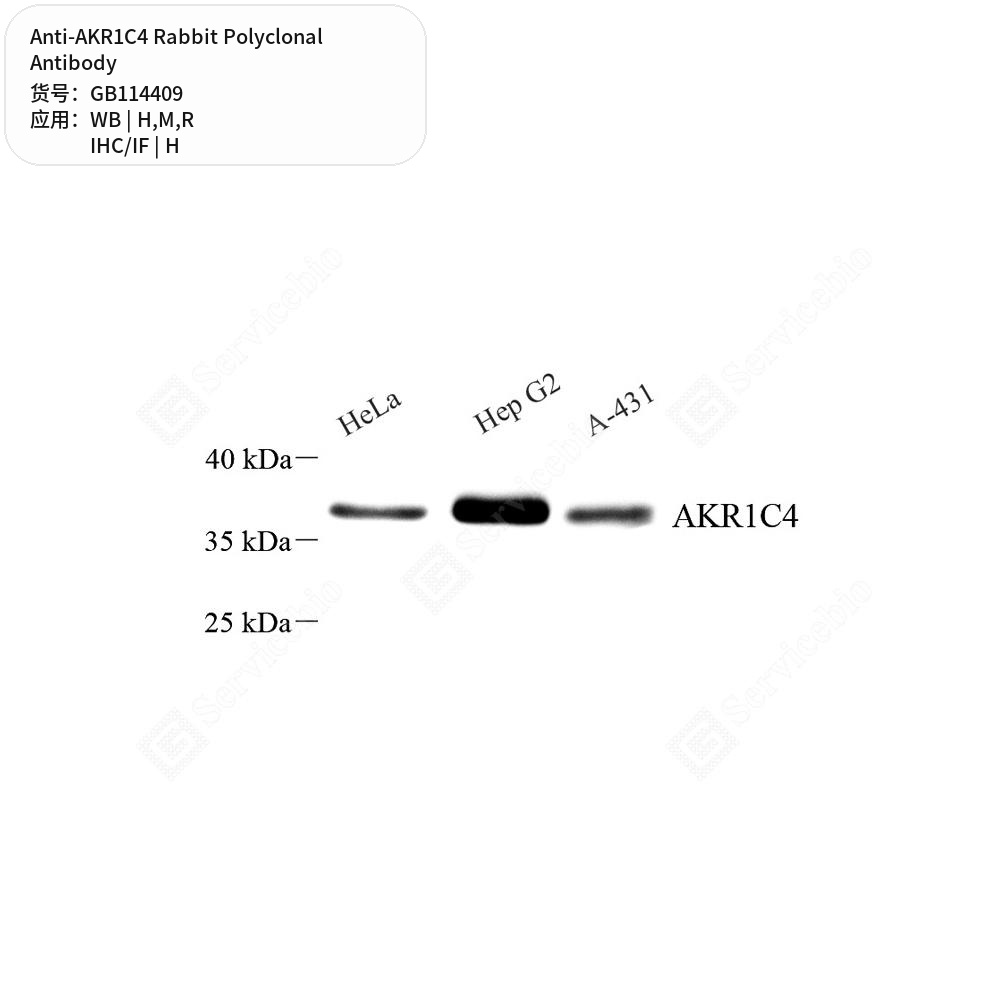 Антитела первичные, поликлональные кролика к AKR1C4 крысы, мыши, человека, 100 мкл