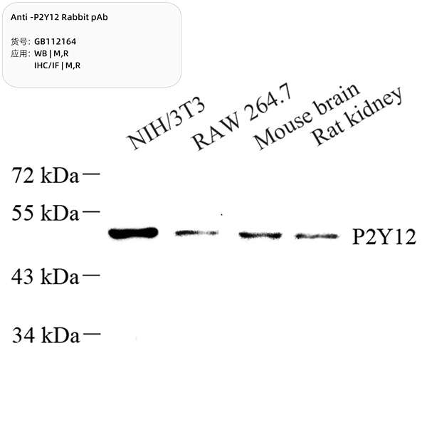 Антитела первичные, поликлональные, P2Y12, 100 мкл