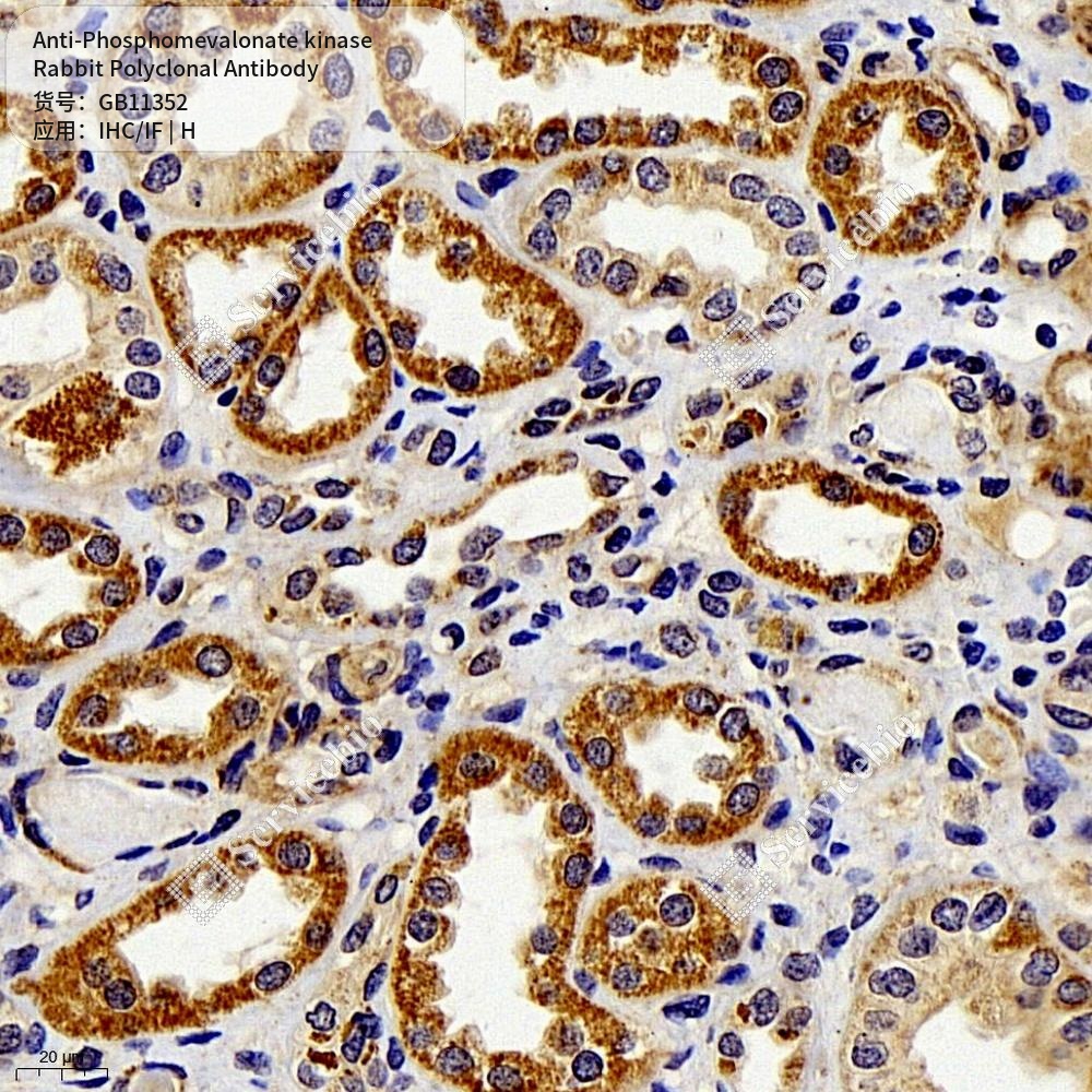 Антитела первичные, поликлональные кролика к Phosphomevalonate kinase человека, 50 мкл