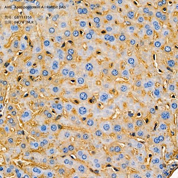 Антитела первичные, поликлональные, Apolipoprotein A I, 100 мкл