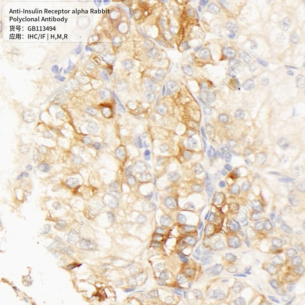 Антитела первичные, поликлональные кролика к Insulin Receptor alpha крысы, мыши, человека, 50 мкл