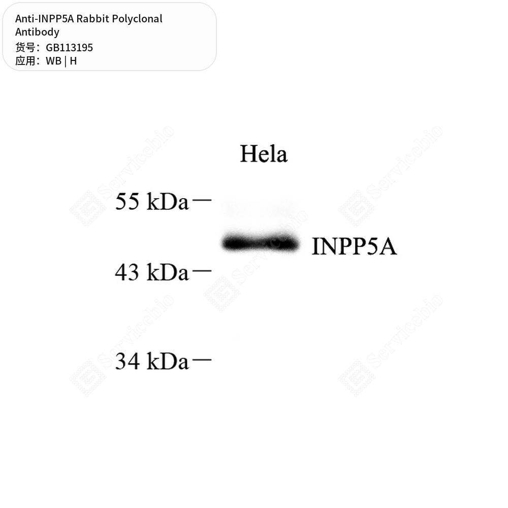 Антитела первичные, поликлональные кролика к INPP5A человека, 50 мкл