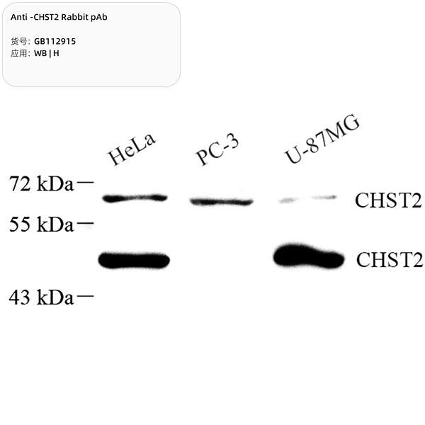 Антитела первичные, поликлональные, CHST2, 100 мкл