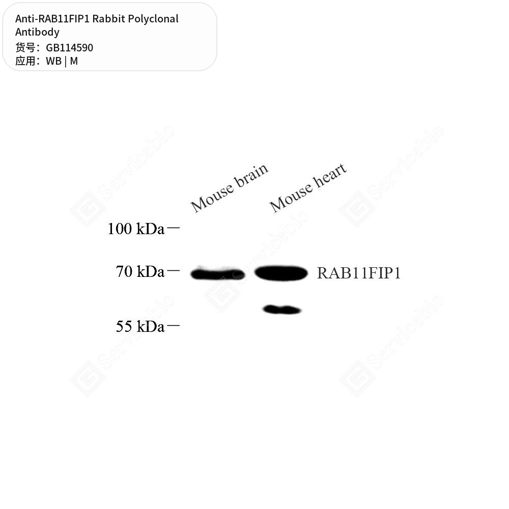 Антитела первичные, поликлональные кролика к RAB11FIP1 мыши, 50 мкл