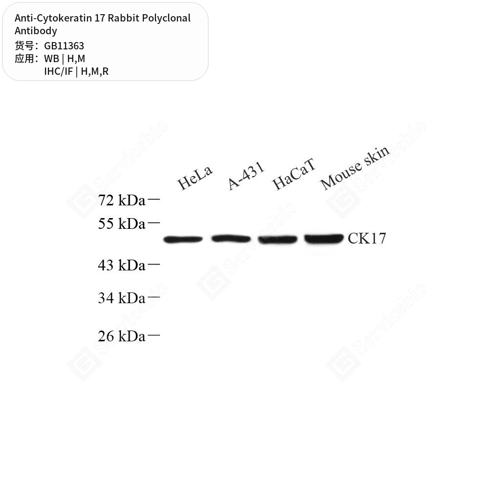 Антитела первичные, поликлональные кролика к Cytokeratin 17 крысы, мыши, человека, 100 мкл
