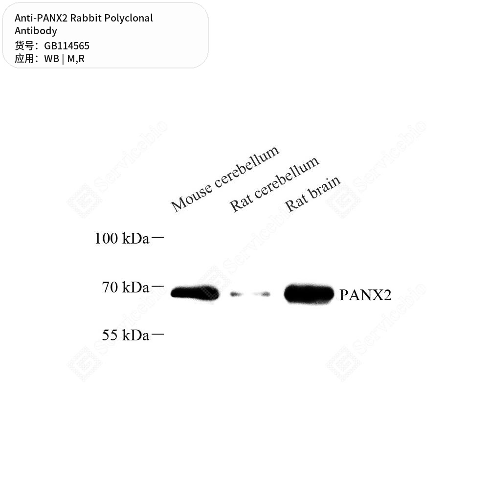 Антитела первичные, поликлональные кролика к PANX2 крысы, мыши, 100 мкл