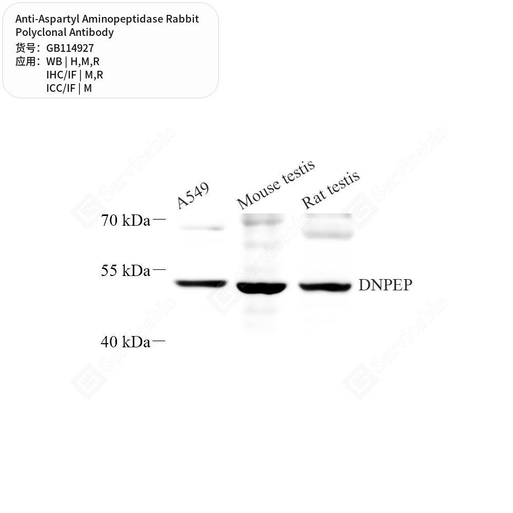 Антитела первичные, поликлональные кролика к Aspartyl Aminopeptidase крысы, мыши, человека, 50 мкл