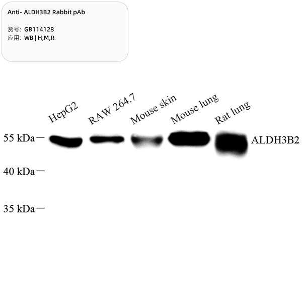 Антитела первичные, поликлональные, ALDH3B2, 100 мкл