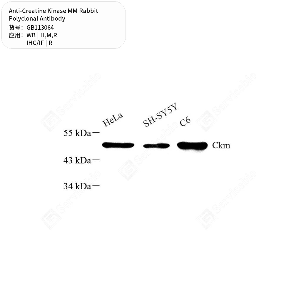 Антитела первичные, поликлональные кролика к Creatine Kinase MM крысы, мыши, человека, 100 мкл