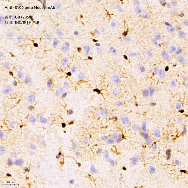 Антитела первичные, моноклональные, S100 beta, 100 мкл
