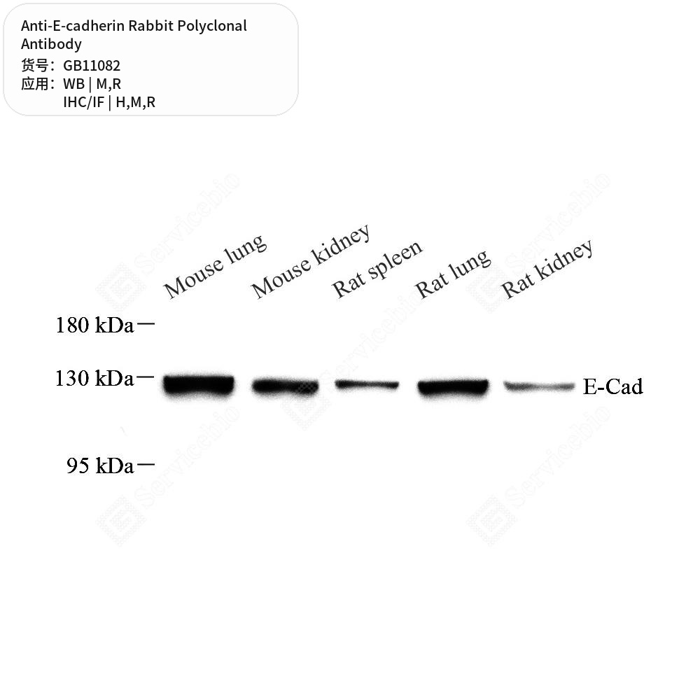 Антитела первичные, поликлональные кролика к E-cadherin крысы, мыши, человека, 100 мкл