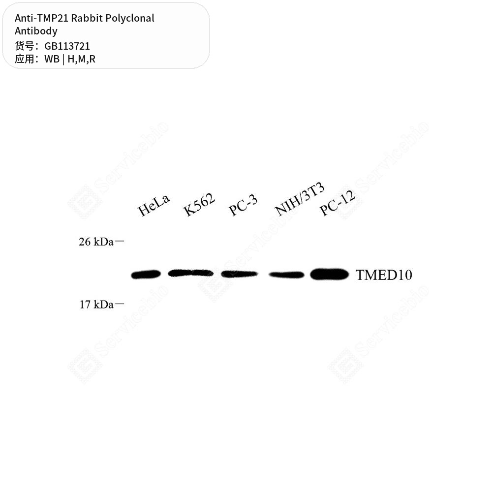 Антитела первичные, поликлональные кролика к TMP21 крысы, мыши, человека, 50 мкл