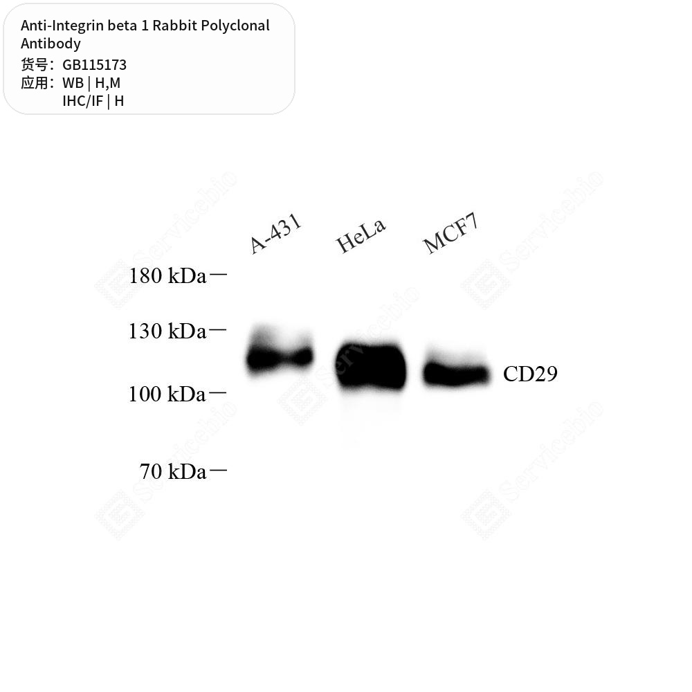 Антитела первичные, поликлональные кролика к Integrin beta 1 мыши, человека, 50 мкл